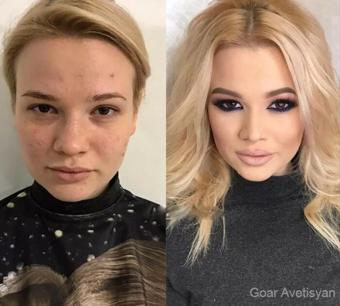 Преображение людей до и после. Преображение 10. Гоар аветисян. Ассоль васильева до и после операции. Гоар аветисян.