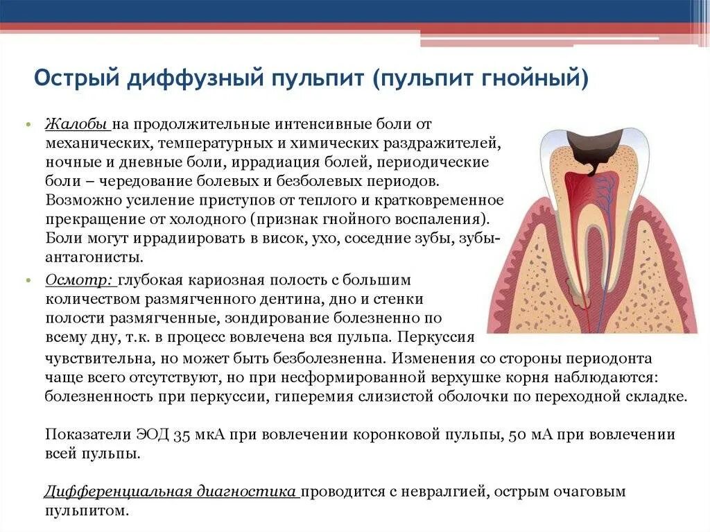 Хроническое заболевание полости. Острый очаговыф пульпит ПАТ анатомия. 4 Клинические проявления острого диффузного пульпита. Острый очаговый пульпит зуба 1.1. Острый серозный очаговый пульпит.