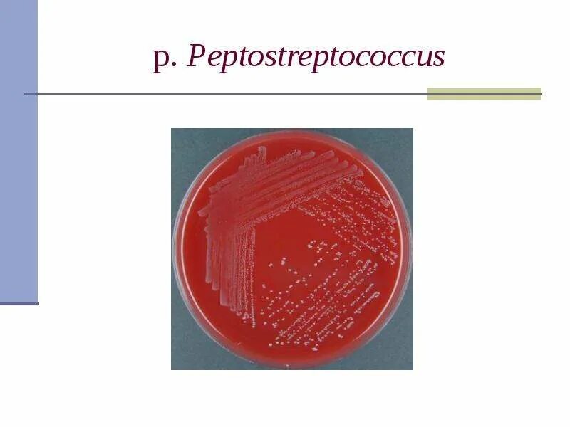 Peptostreptococcus. Пептострептококки микробиология. Анаэробные стрептококки пептострептококки. Пептострептококки морфология. Пептострептококки анаэробы.