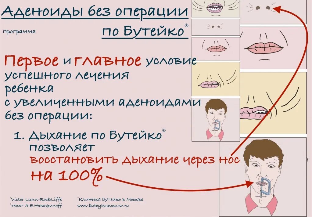 Облегчить дыхание носом. Упражнение для облегчения дыхания носа. Дыхательная гимнастика при аденоидах. Дыхательная гимнастика при аденоидах для детей. Дыхательная гимнастика для аденоид.