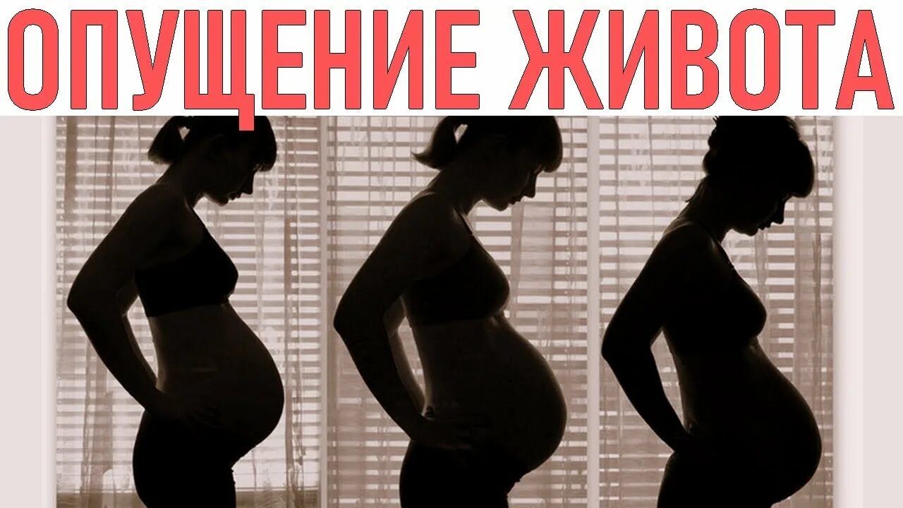 Должен ли опускаться живот. Опущенный живот при беременности до и после. опущенный живот перед родами. опущение живота перед родами. опущение живота передбродами.