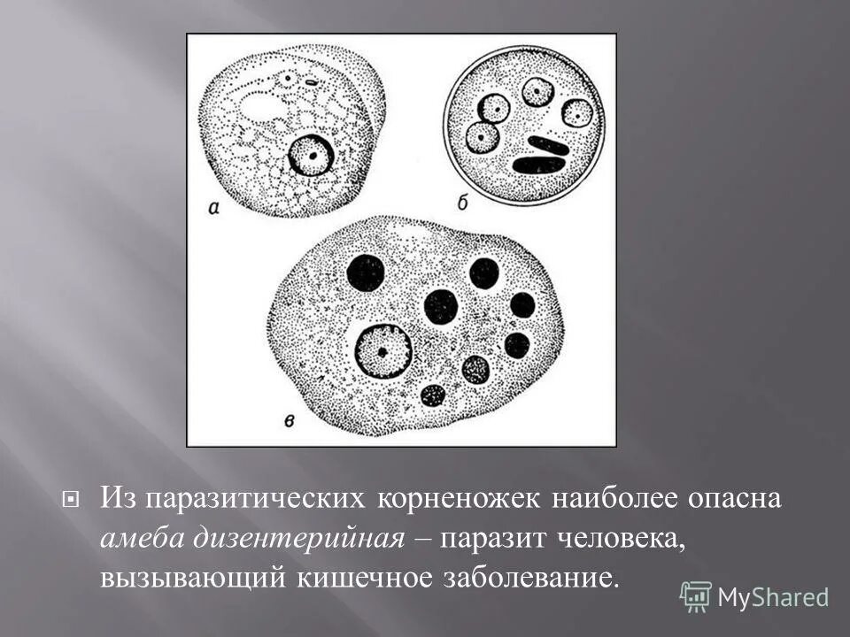 Амеба дизентерийная локализация в организме. Амеба дизентерийная локализация в организме. Крупная вегетативная форма дизентерийной амебы. Дизентерийная амеба строение. Дизентерийная амеба.