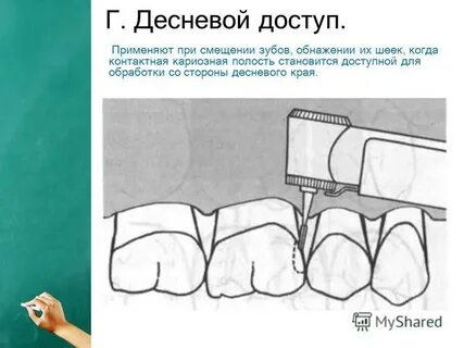 Помощь блэку