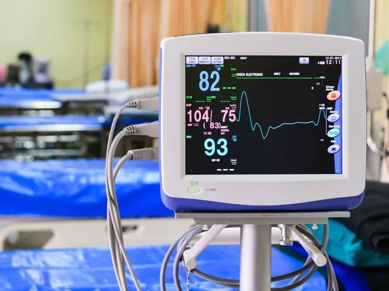 Показатели в реанимации. Монитор реанимационный и анестезиологический митар-01-р-д дисплей 12,1,. Ekg monitor in icu unit. Аппарат ивл показатели на мониторе. Мониторы для мониторинга в больнице.