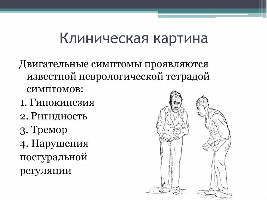 Ригидность паркинсон. Ригидно-дрожательная форма болезни паркинсона. Ригидность паркинсон. Движения глаз при болезни паркинсона характеризуются. Ригидность паркинсон.