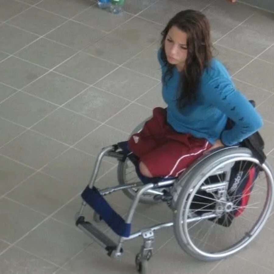 Девушки инвалиды без рук. Ампути 2022. Девушки инвалиды без рук. Девочка инвалид. Девочка инвалид.