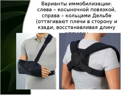 Иммобилизация ключицы