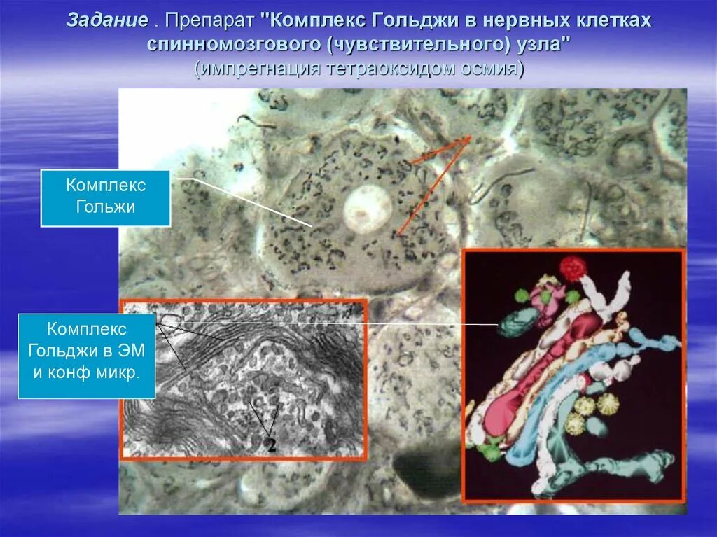 Комплекс Гольджи окраска импрегнация серебром. Аппарат Гольджи спинального ганглия. Комплекс Гольджи в клетках спинального ганглия импрегнация серебром. Комплекс Гольджи в световом микроскопе. Пластинчатый комплекс