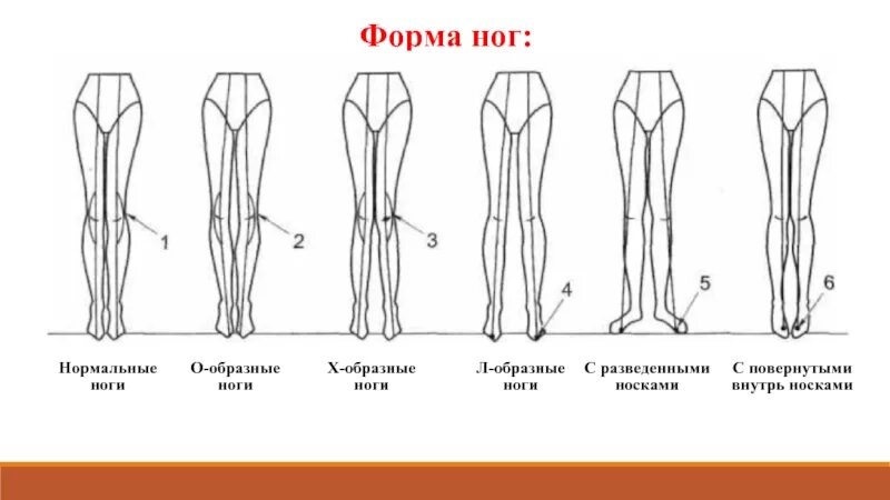 Какие должны быть ноги