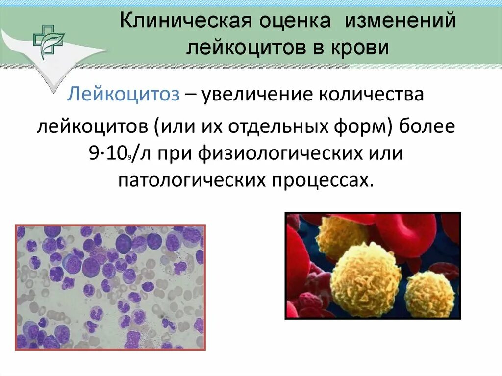 Изменения лейкоцитов. Патологические лейкоциты. Количественные изменения лейкоцитов. Морфология лейкоцитов крови. Лейкоцитоз у мужчин