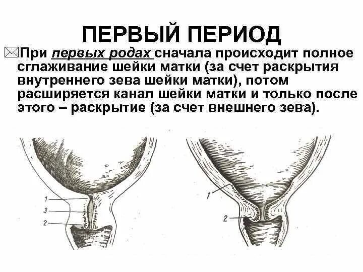 Зев закрыт при беременности