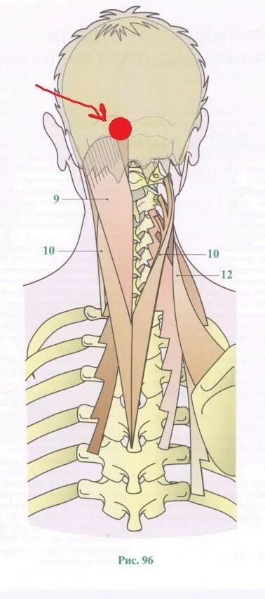 Шишечка задней части головы и шеи. Шишечка на задней части шеи. Выпирающач кость га заьвлке.