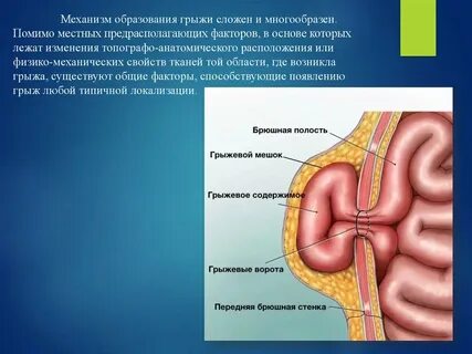 Пупочное кольцо это