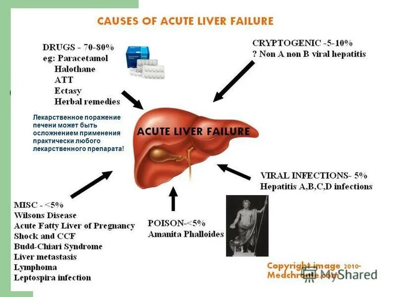 Acute перевод. Лекарственное поражение печени. Острое повреждение печени. Печень пораженная лекарствами.