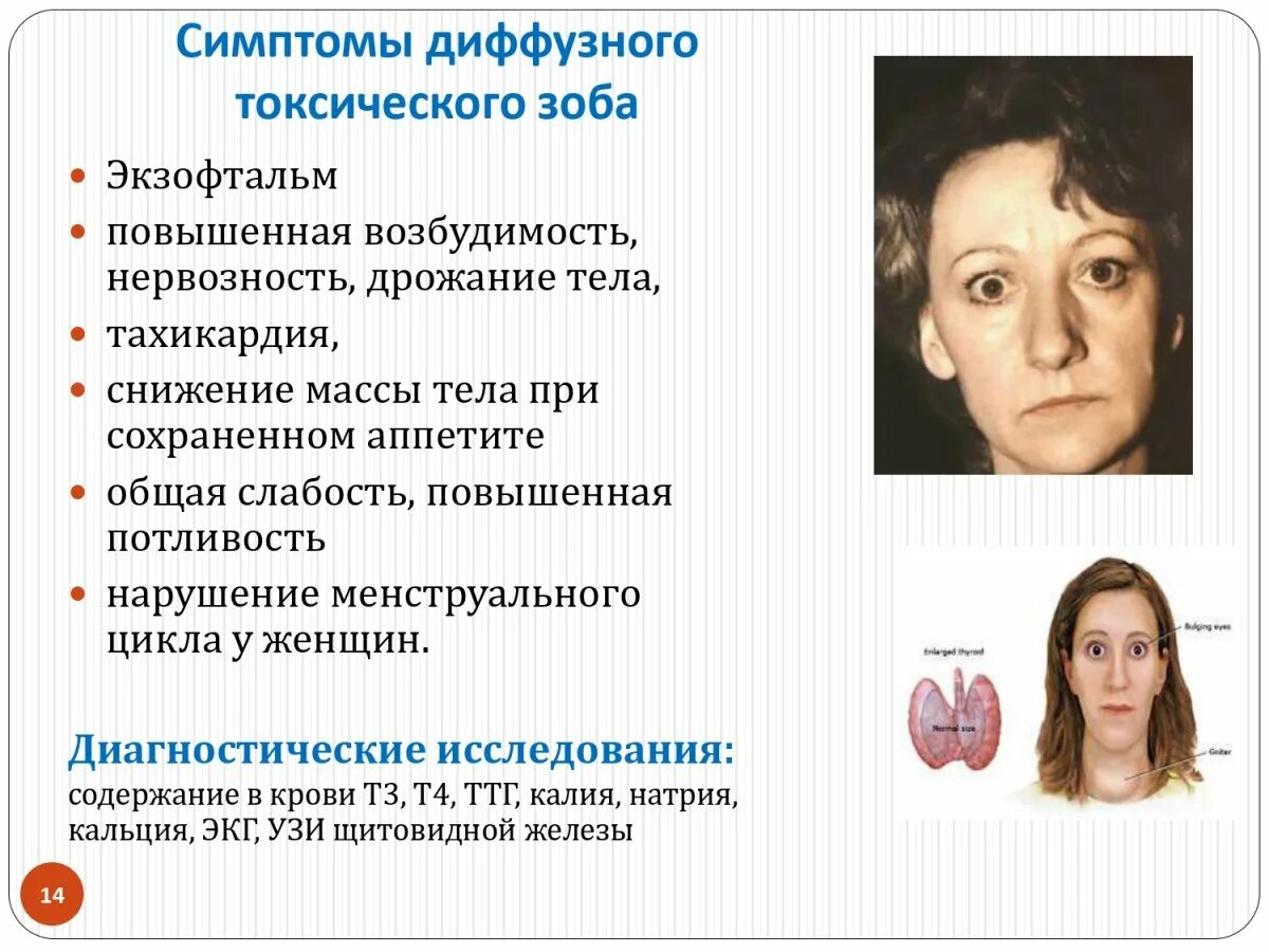 При гиперфункции щитовидной железы основной обмен. Токсический зоб экзофтальм. триада симптомов гипертиреоза. гиперфункция щитовидной железы (гипертиреоз). синдром повышения функции щитовидной железы (тиреотоксикоз.
