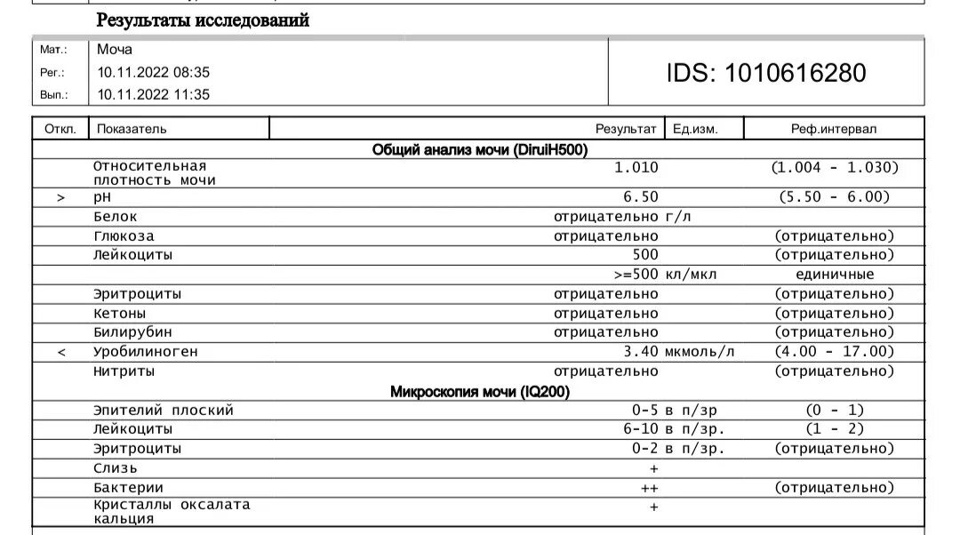 Моча по нечипоренко норма у женщин таблица. Норма лейкоцитов в моче по Нечипоренко у мужчин. Плохая моча при беременности. Глюкоза в моче при беременности. Сазар в моче в суточной моче при беременности норма.