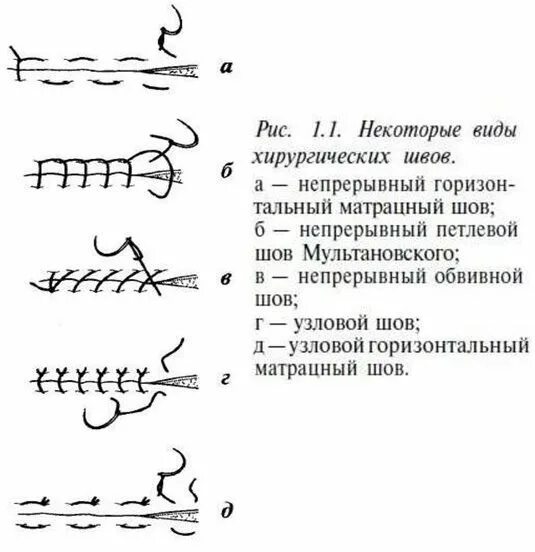 Как правильно зашивать рану Surgical suture, Medical knowledge, Emergency medici