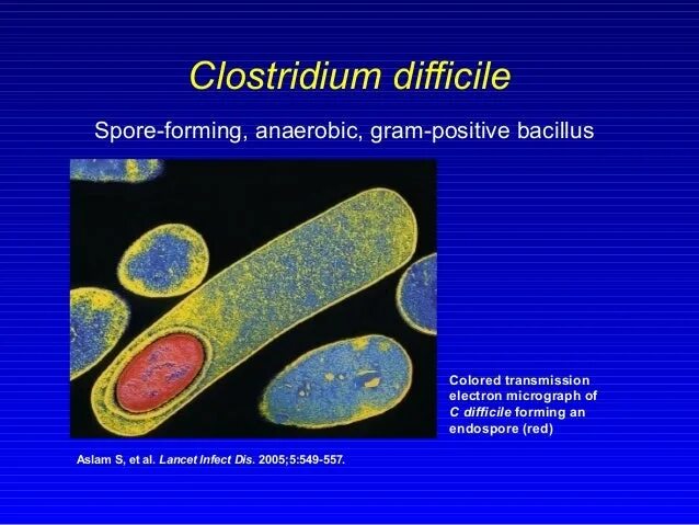 Clostridium difficile что это. Клостридия диффициле Clostridium. Морфология столбнячной клостридии. Clostridium difficile микробиология.
