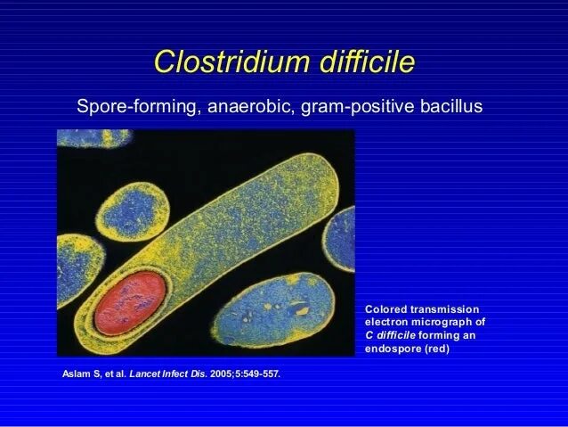 Клостридия диффициле Clostridium. Морфология столбнячной клостридии. Clostridium difficile микробиология. Clostridium difficile что это