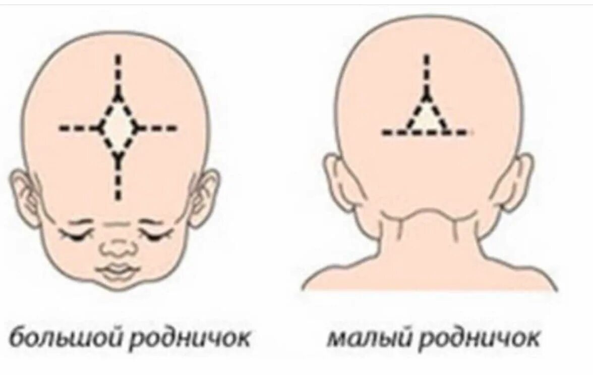 У ребенка 2 родничка. Передний Родничок черепа новорожденного. Большой Родничок и малый Родничок у новорожденного. Родничок у новорожденных передний задний. Незакрытые роднички у новорожденных.