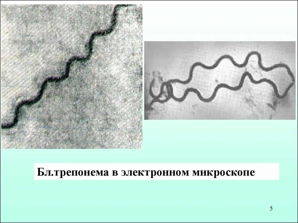 Спирохеты вызывают заболевания. Бледная трепонема микроскоп. Бледная трепонема микробиология. Трепонема паллидум морфология. Формы трепонемы паллидум.