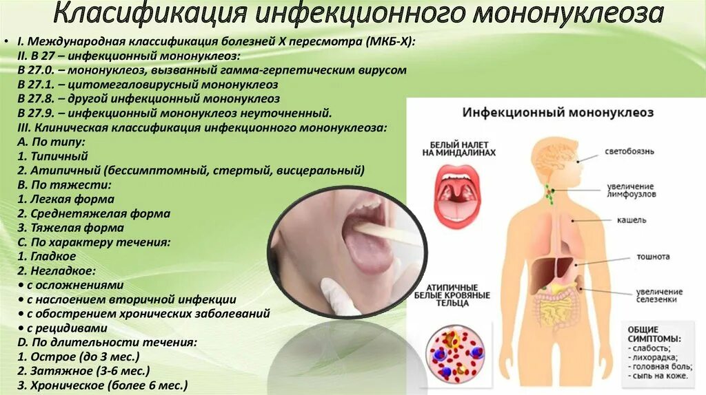 Сыпь температура боль в горле у ребенка. Мононуклеоз характерный симптом. Мононуклеоз крапивница. Мононуклеоз клиническая картина. Инфекционный мононуклеоз патология.