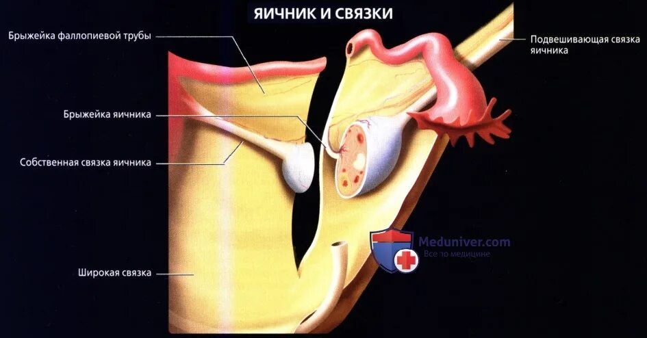 Собственная связка яичника. Собственная и подвешивающая связка яичника. Подвешивающая связка яичника.