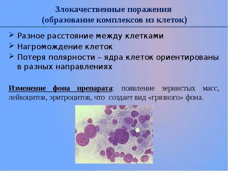 Отсутствие внутриэпителиального поражения или злокачественности