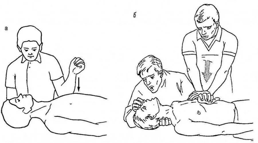 Непрямой массаж сердца схема. Непрямой массаж сердца при инфаркте. Непрямой массаж сердца рисунок. Непрямой массаж сердца иллюстрация.