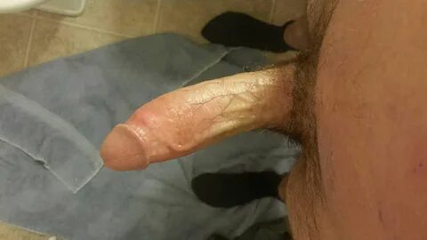 Slideshow xiao getting his dick cut.