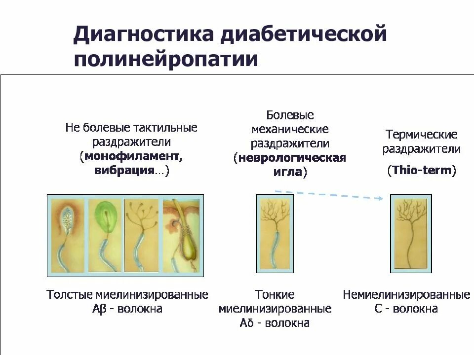 Диагностика диабетической полинейропатии. Диабетическая полинейропатия нижних конечностей. Диета при диабетической полинейропатии. Диета при диабетической полинейропатии нижних конечностей. Диагностика диабетической нейропатии