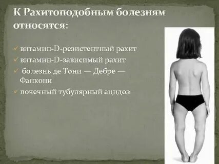 Рахитоподобные заболевания