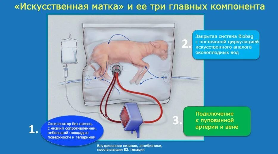 Искусственная матка для вынашивания ребенка. Ребенок выращенный в искусственной матке.