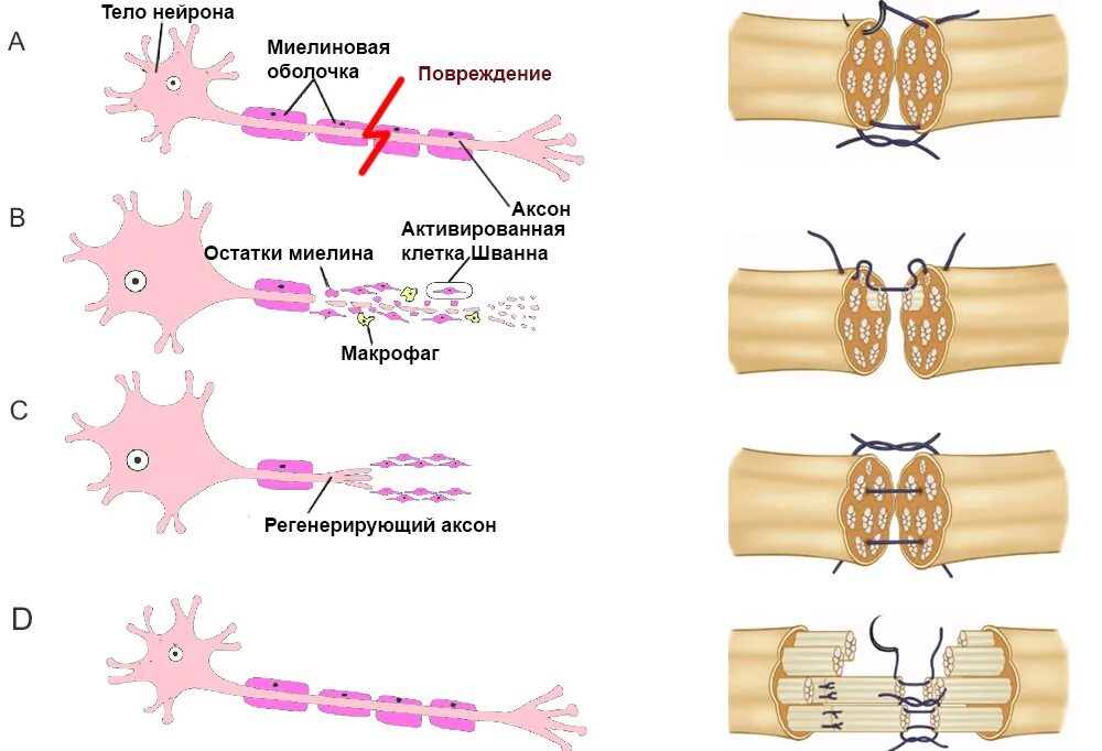 Сшивание нерва латынь. Техника сшивания нерва. Эпиневральный шов нерва.