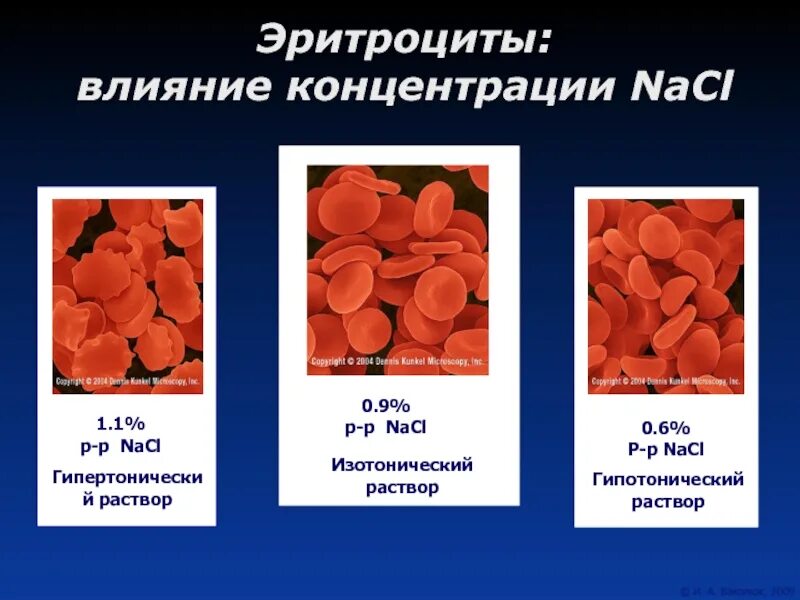 Эритроциты хлорид натрия. Эритроциты в растворах разной концентрации. эритроцит в различных концентрациях. эритроциты в изотоническом растворе. эритроциты в растворе соли.