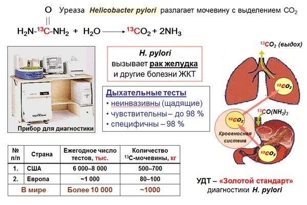 Подготовка к уреазному дыхательному тесту. Тест хеликобактер дыхательный тест. С13 дыхательный тест на хеликобактер. 13с-уреазный дыхательный тест на хеликобактер пилори норма. Дыхательный тест на хеликобактер пилори картинки.