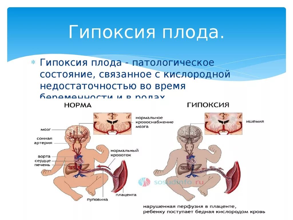 Кислородное голодание плода. Кислородное голодание у новорожденного. Антенатальная гипоксия плода.