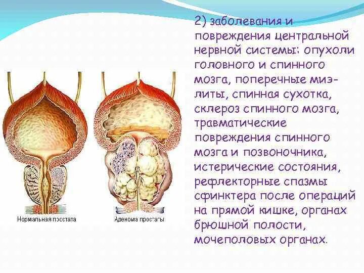 Болезни мочеполовой системы. Хирургические патологии мочевыделительной системы. Опухоли мочеполовой системы. Заболевания и повреждения мочеполовой системы хирургия.