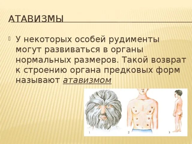 Атавизмы и рудименты человека примеры. Атавизмы человека гипофиз. атавизмы и рудименты человека. рудименты и атавизмы у человека таблица.