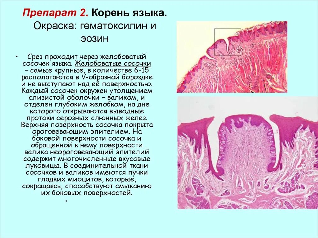 Листовидные сосочки языка анатомия. Желобовидные сосочки языка гистология. Желобовидные сосочки языка строение. Желобовидный сосочек языка. Желобовидный сосочек языка.