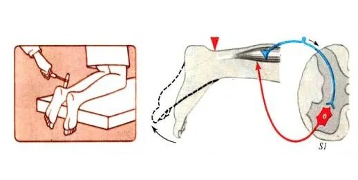 Рефлекторная дуга ахиллова рефлекса. Схема дуги ахиллова рефлекса. Ахиллов рефлекс схема. Ахиллов рефлекс схема рефлекторной дуги.
