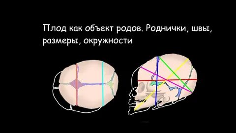 Швы и размеры головки