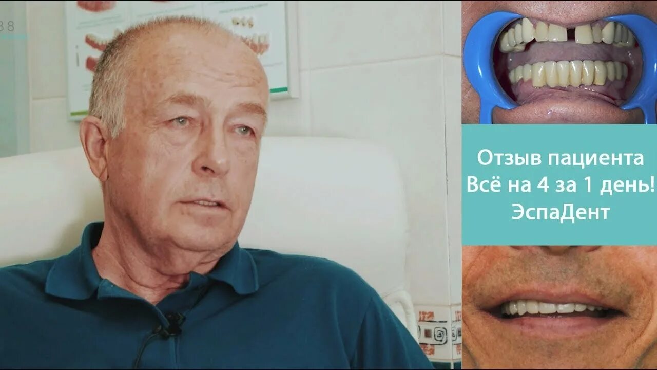 Зубы на имплантах отзывы реальных пациентов. Зубы на имплантах отзывы реальных пациентов. Все на 4 имплантация отзывы. Зубы на имплантах отзывы реальных пациентов. Зубные импланты отзывы.