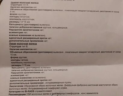 Что значит интрамаммарные лимфоузлы