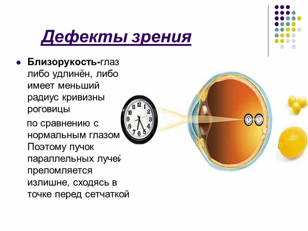 Дефекты зрения ответы. Дефекты зрения очки физика 8 класс. Дефекты зрения близорукость. Дефекты зрения миопия. Глаз. Дефект зрения..