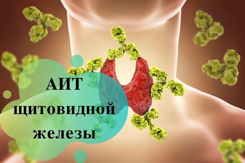 Аутоиммунные заболевания щитовидной железы тиреоидит. Аутоиммунный тиреоидит щитовидной железы что это такое. Тиреоидит щитовидной железы что это такое.