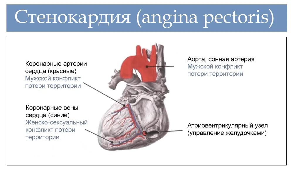 Причины стенокардии у мужчин. Сердце при стенокардии. Стенокардия грудная жаба. Заболевания сердечно сосудистой системы это стенокардия?.