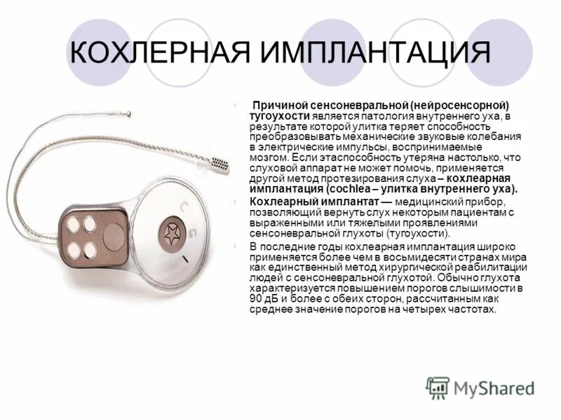 Как улучшить слух при тугоухости. Слуховой аппарат тугоухость 4. слуховые аппараты при тугоухости. слуховые аппараты для нейросенсорной тугоухости. кохлеарная имплантация при нейросенсорной.