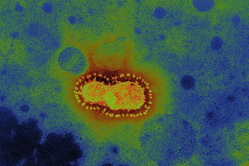 Строение вируса коронавируса covid 19. Coronavirus am. Вирус covid 19 под микроскопом. Coronavirus строение. Coronavirus am.