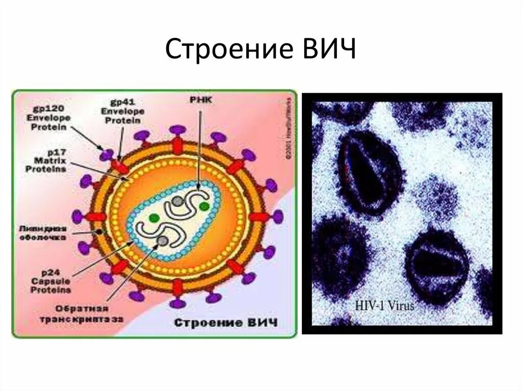 Строение вич. Вирус иммунодефицита человека строение. Структура вируса иммунодефицита человека. Строение вируса ВИЧ.